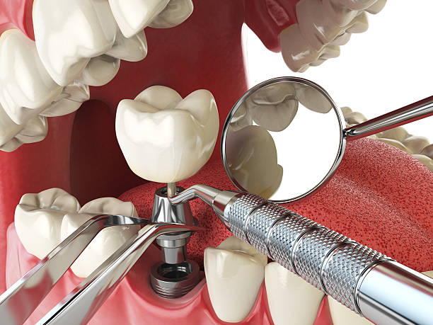 Best Tooth Infection Emergency Dentist  in Glendora, CA